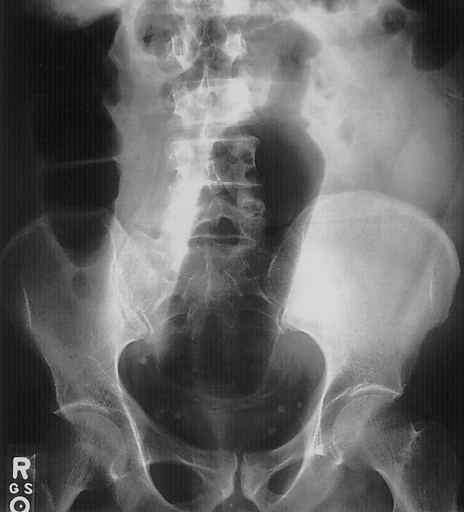 Exray of penis inside vagina Not Exray of penis inside vagina opinion